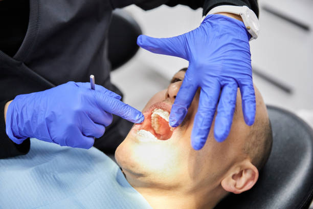 Best Walk-In Emergency Dental Services in San Castle, FL